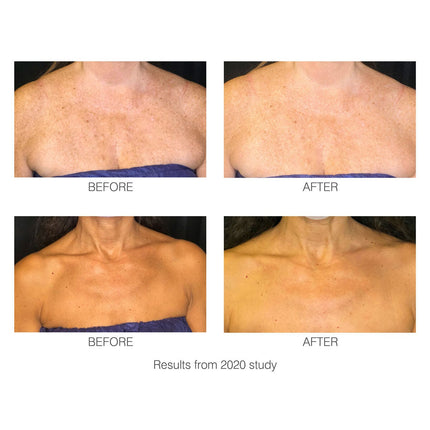 Rio decoLITE Beauty Boosting LED Treatment – view 5