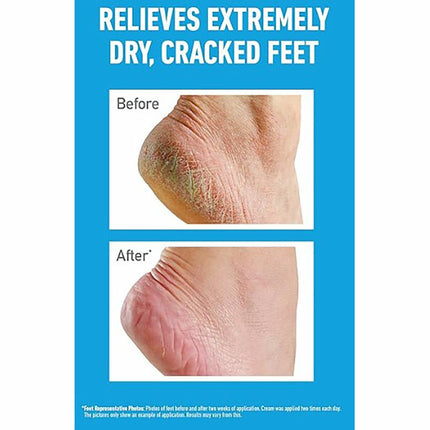 O'Keeffe's Healthy Feet Original, 2 x 180ml – view 4