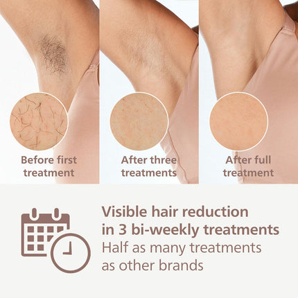 Philips BRI958/00 9000 Series Lumea IPL Hair Removal Device – view 3